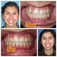 Before & After